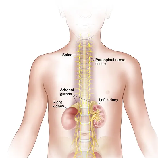 Neuroectodermal Tumor - Symptoms, Types, Causes & Diagnosis